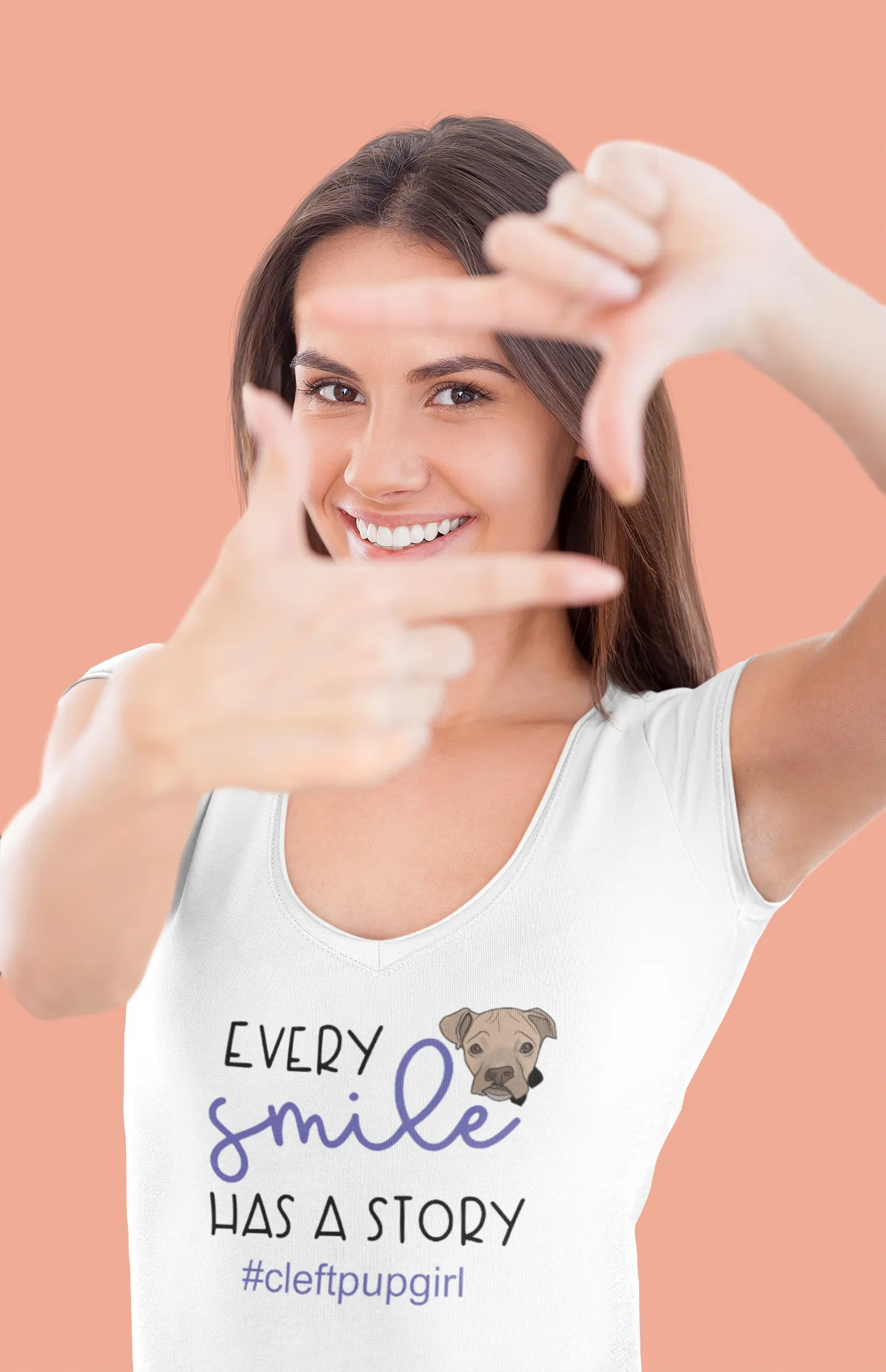 Cleft Pup Brigade V Neck Smile (available in several colors)