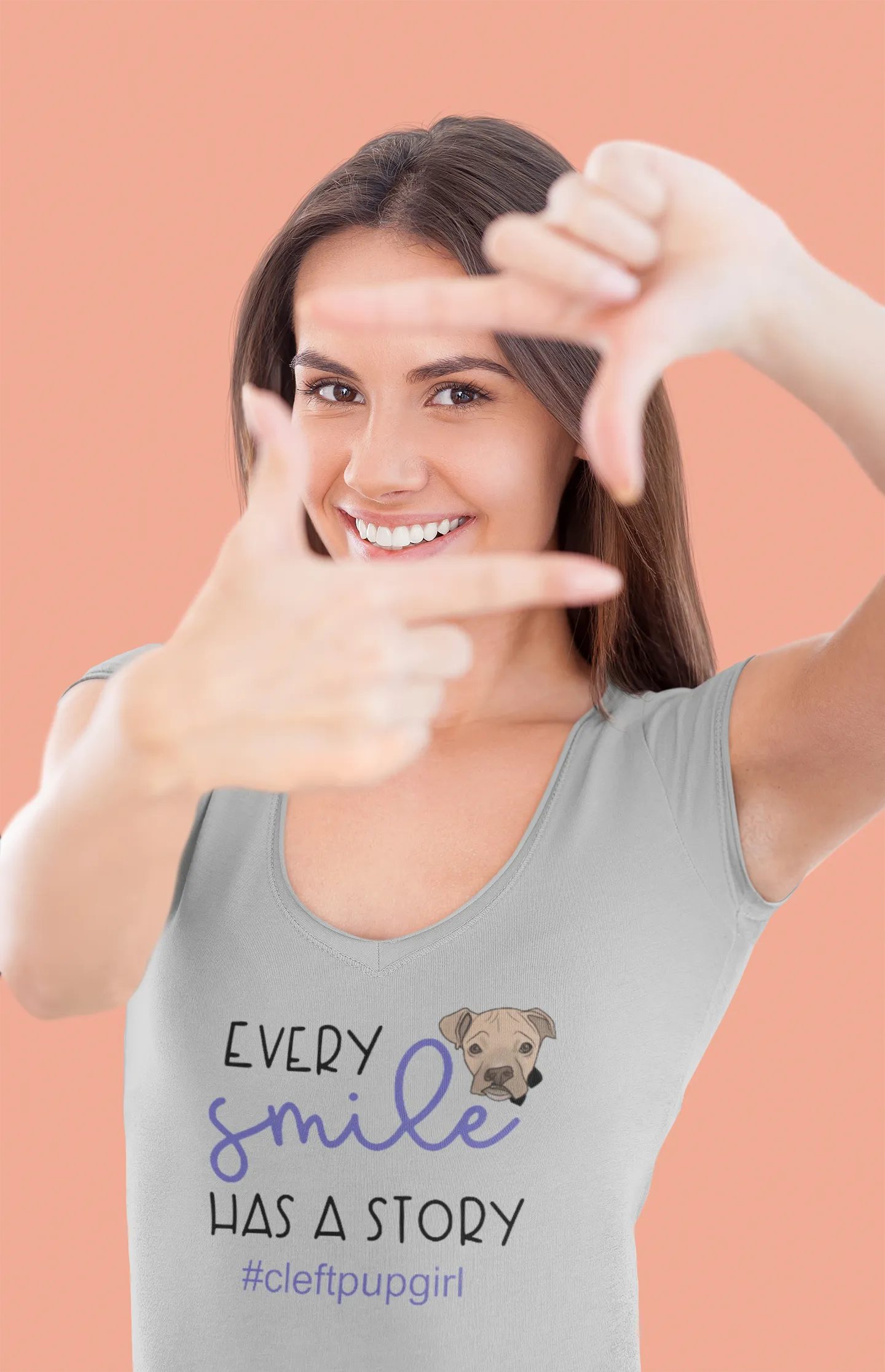 Cleft Pup Brigade V Neck Smile (available in several colors)